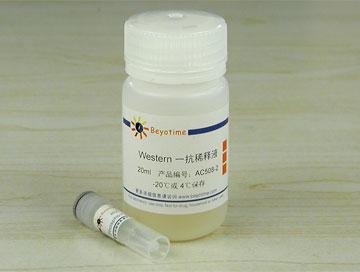 Phospho-Chk2(Thr68)抗体(兔多抗)